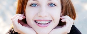 girl-with-braces-604x238