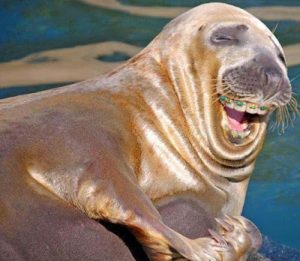 sealion-with-braces