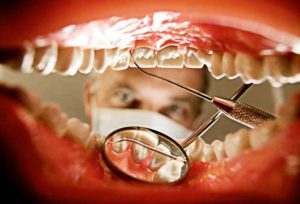 dentist-looking-inside-mouth